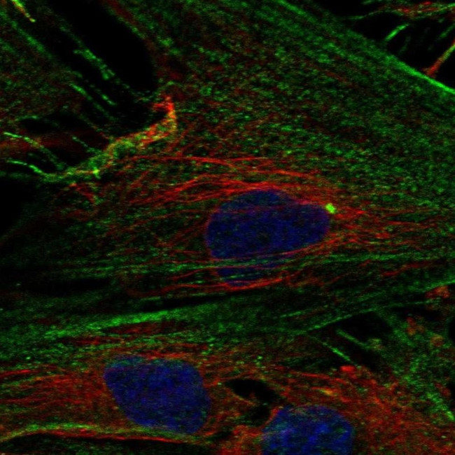 NPTX2 Antibody in Immunocytochemistry (ICC/IF)