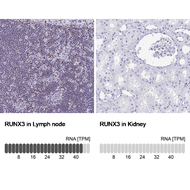 RUNX3 Antibody in Immunohistochemistry (Paraffin) (IHC (P))