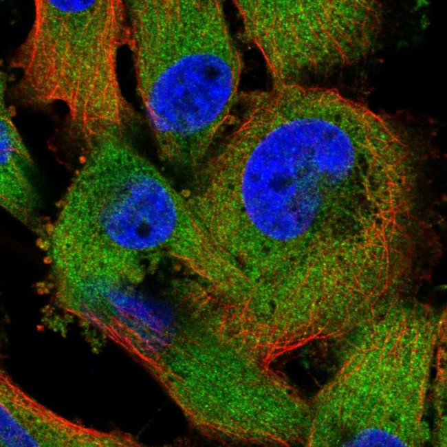 ZC3HAV1 Antibody in Immunocytochemistry (ICC/IF)