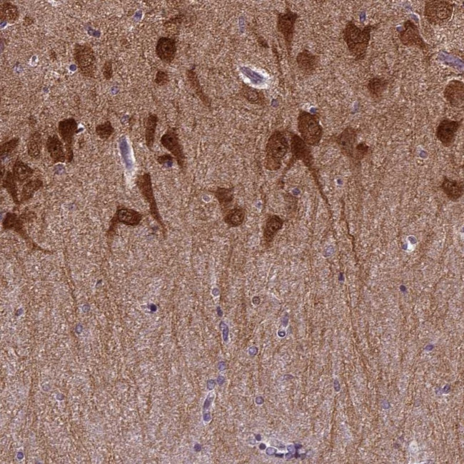 PRRT1 Antibody in Immunohistochemistry (Paraffin) (IHC (P))