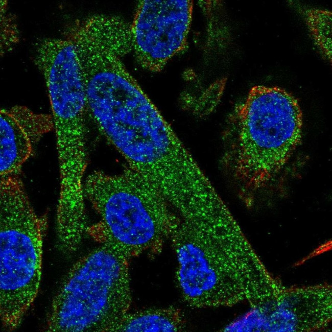 PPP2R5A Antibody in Immunocytochemistry (ICC/IF)
