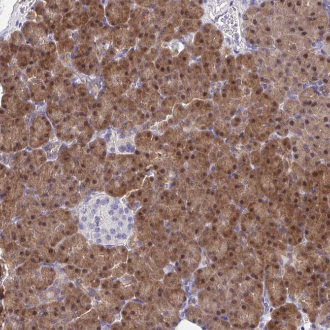 HOXD12 Antibody in Immunohistochemistry (Paraffin) (IHC (P))
