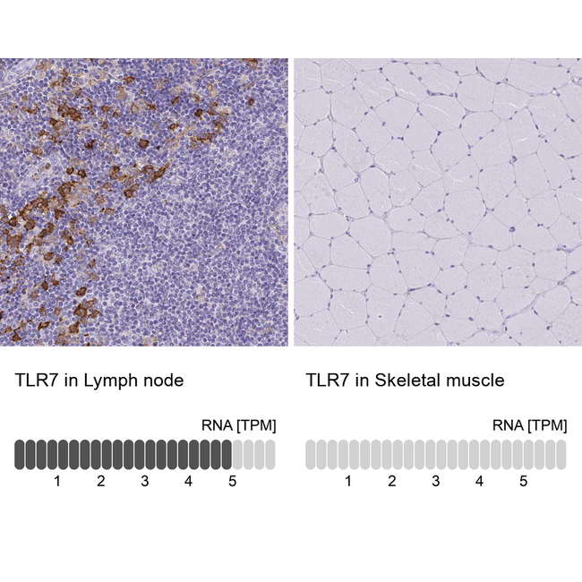 TLR7 Antibody in Immunohistochemistry (Paraffin) (IHC (P))