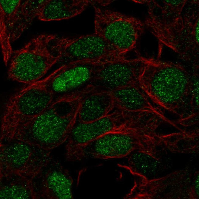 FOXQ1 Antibody in Immunocytochemistry (ICC/IF)