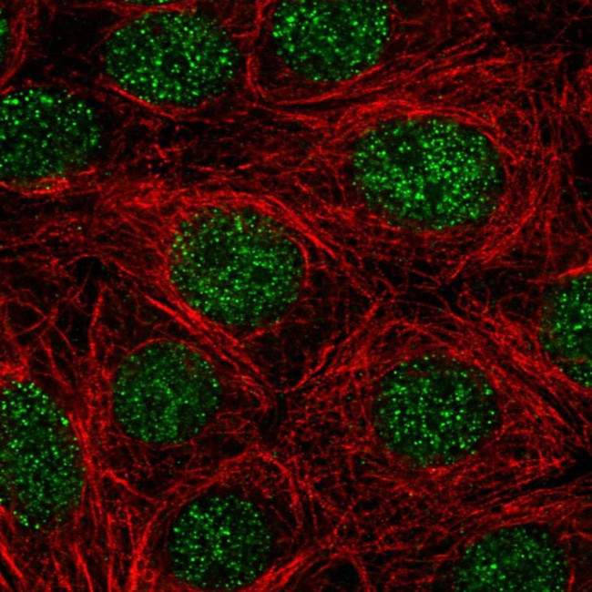 NR4A1 Antibody in Immunocytochemistry (ICC/IF)