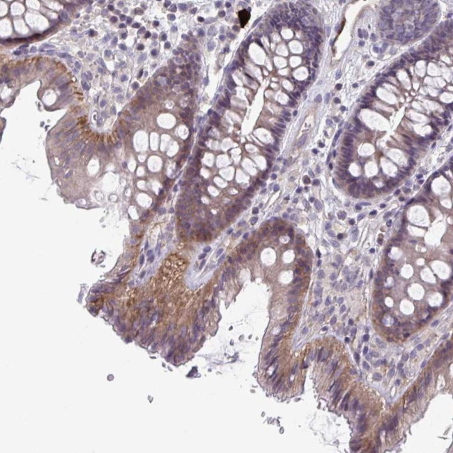 MST4 Antibody in Immunohistochemistry (Paraffin) (IHC (P))