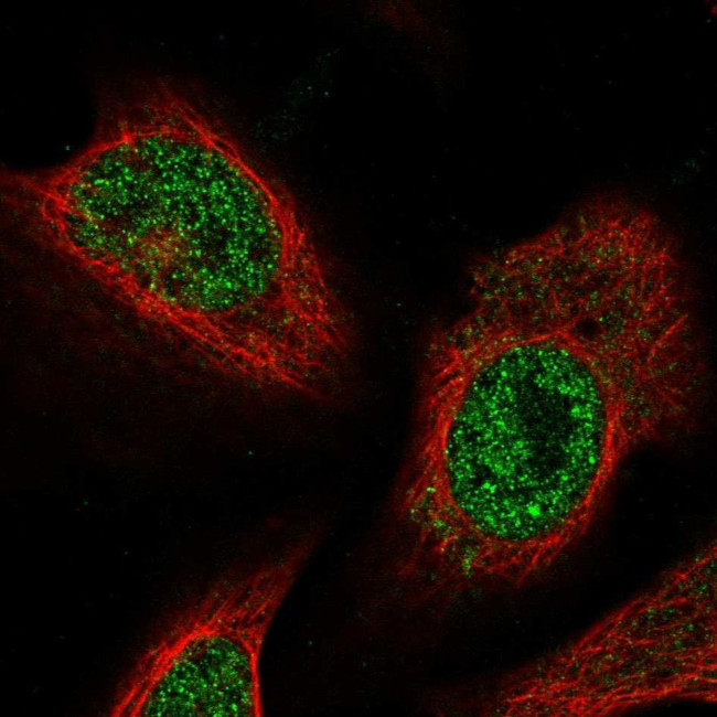 FEM1C Antibody in Immunocytochemistry (ICC/IF)