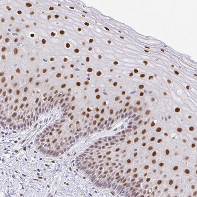 Fra2 Antibody in Immunohistochemistry (Paraffin) (IHC (P))