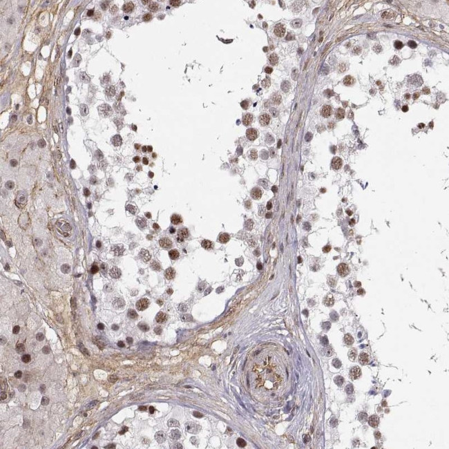 CIR1 Antibody in Immunohistochemistry (Paraffin) (IHC (P))
