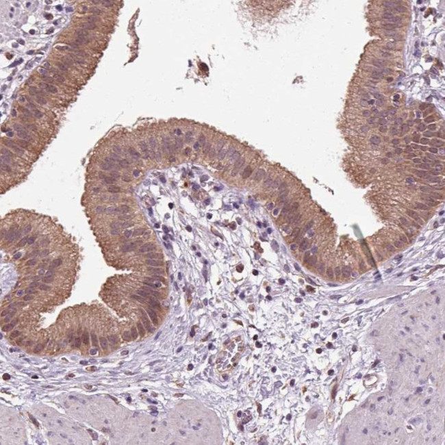 RNPEP Antibody in Immunohistochemistry (Paraffin) (IHC (P))