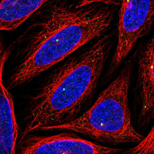 CEP164 Antibody in Immunocytochemistry (ICC/IF)