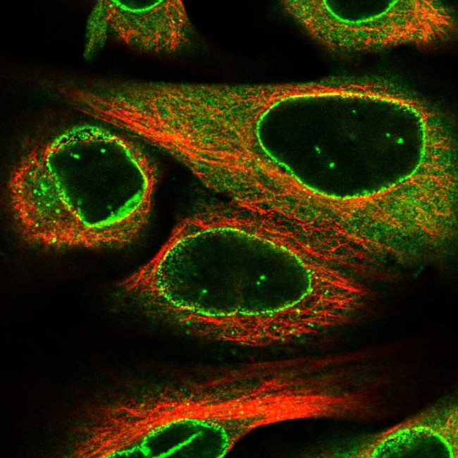 RANGAP1 Antibody in Immunocytochemistry (ICC/IF)