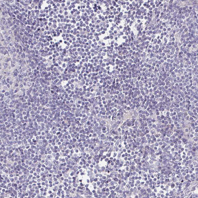 ENPP1 Antibody in Immunohistochemistry (Paraffin) (IHC (P))