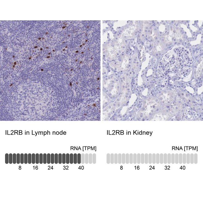 CD122 Antibody in Immunohistochemistry (Paraffin) (IHC (P))