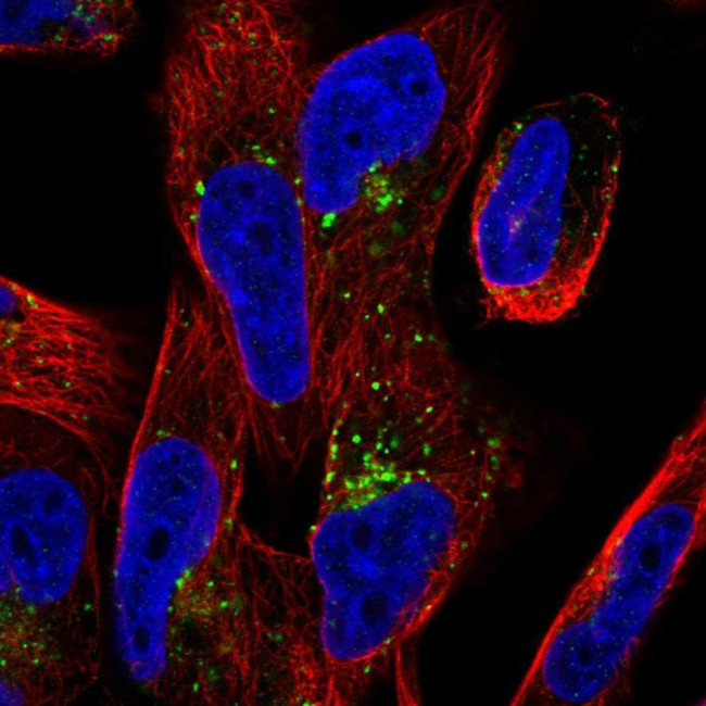 TMEM123 Antibody in Immunocytochemistry (ICC/IF)