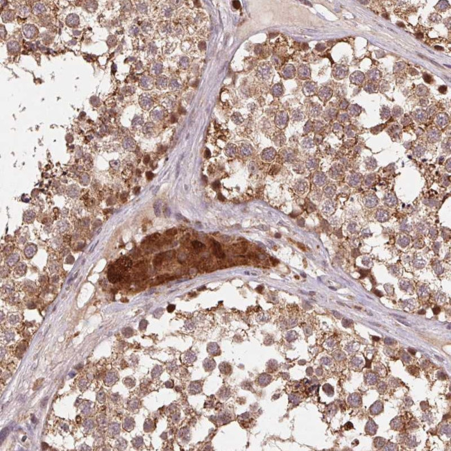 PDHA1 Antibody in Immunohistochemistry (Paraffin) (IHC (P))