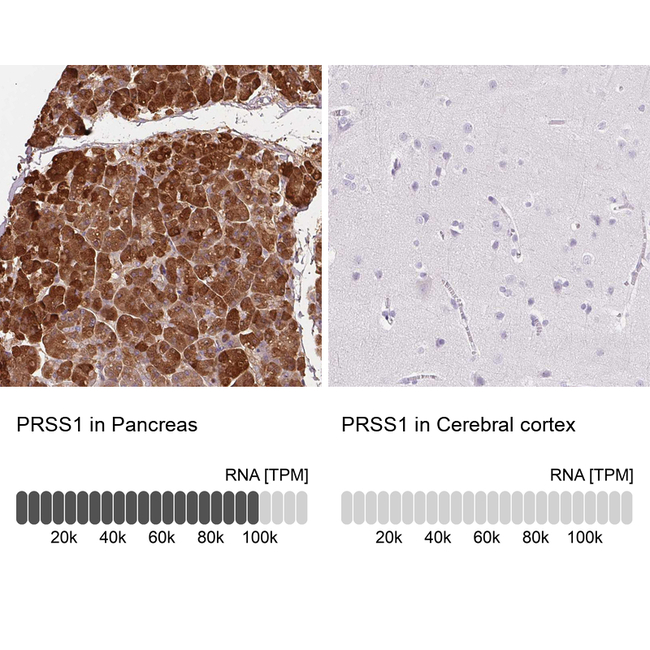 Trypsin Antibody in Immunohistochemistry (Paraffin) (IHC (P))