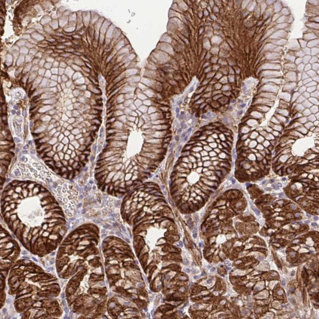 IDE Antibody in Immunohistochemistry (Paraffin) (IHC (P))