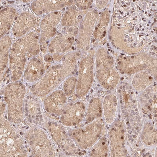 MAPKAPK2 Antibody in Immunohistochemistry (Paraffin) (IHC (P))