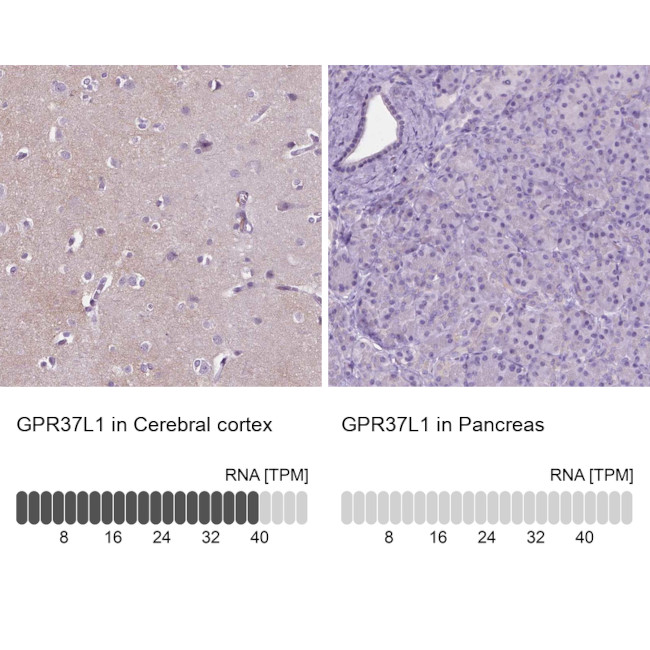 GPR37L1 Antibody in Immunohistochemistry (Paraffin) (IHC (P))