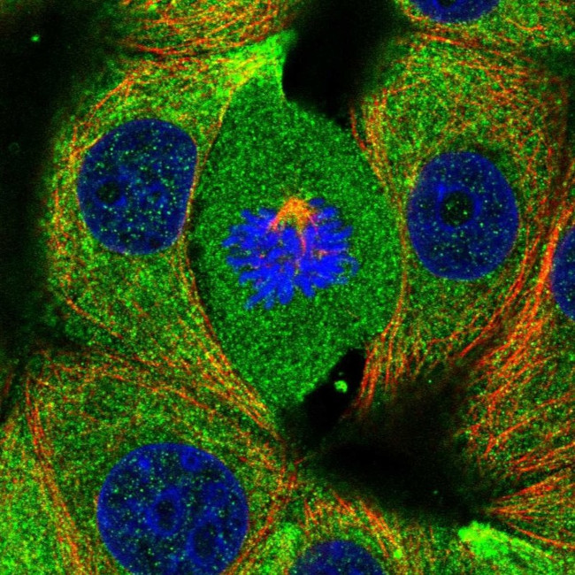 RABGAP1 Antibody in Immunocytochemistry (ICC/IF)