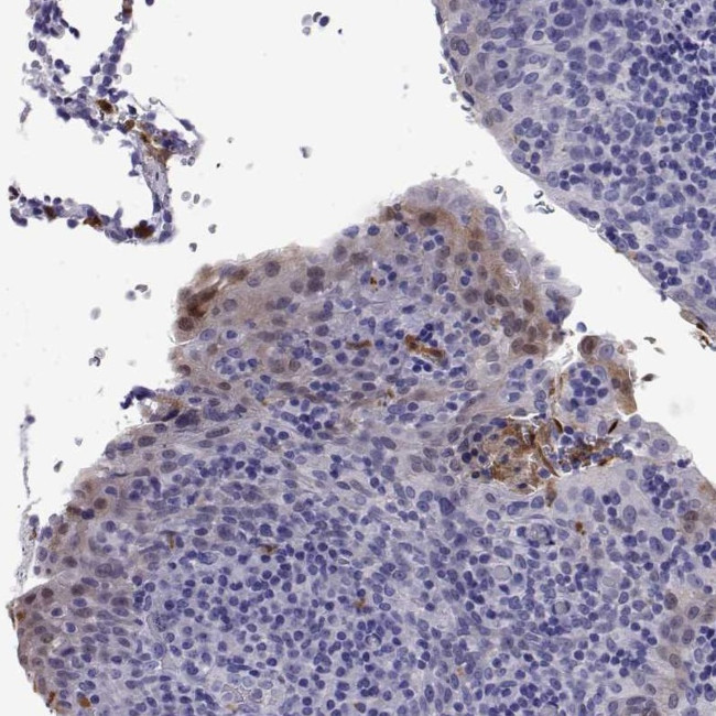 DOK5 Antibody in Immunohistochemistry (Paraffin) (IHC (P))