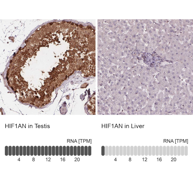 HIF1AN Antibody in Immunohistochemistry (Paraffin) (IHC (P))