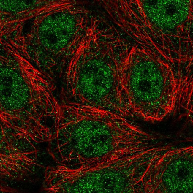 SEMA4A Antibody in Immunocytochemistry (ICC/IF)