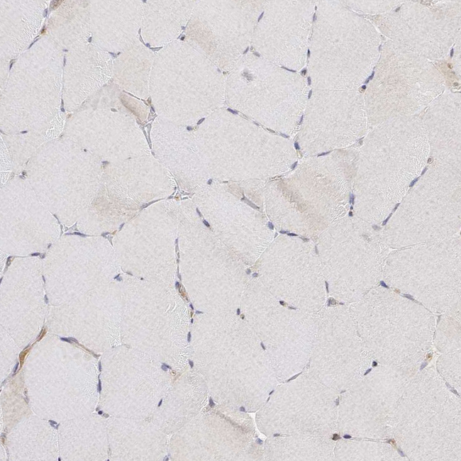 IGFBP4 Antibody in Immunohistochemistry (Paraffin) (IHC (P))