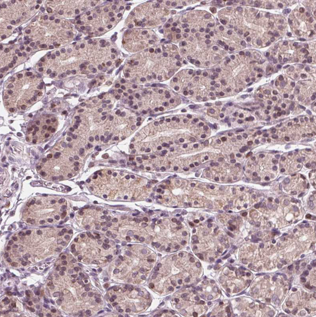 gp210 Antibody in Immunohistochemistry (Paraffin) (IHC (P))