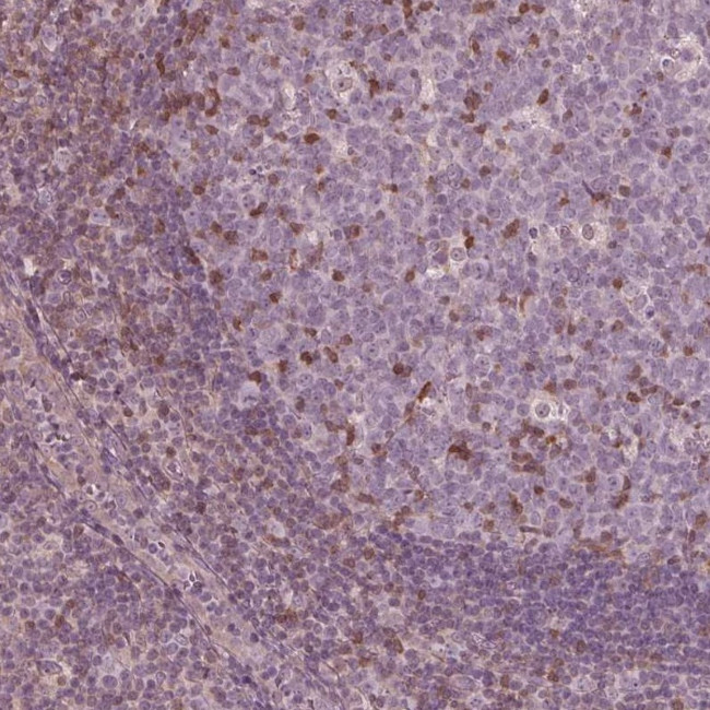 ING3 Antibody in Immunohistochemistry (Paraffin) (IHC (P))