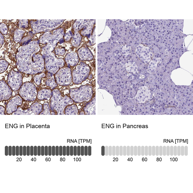 CD105 Antibody in Immunohistochemistry (Paraffin) (IHC (P))