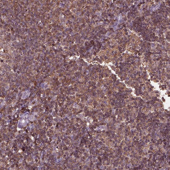 IL31RA Antibody in Immunohistochemistry (Paraffin) (IHC (P))
