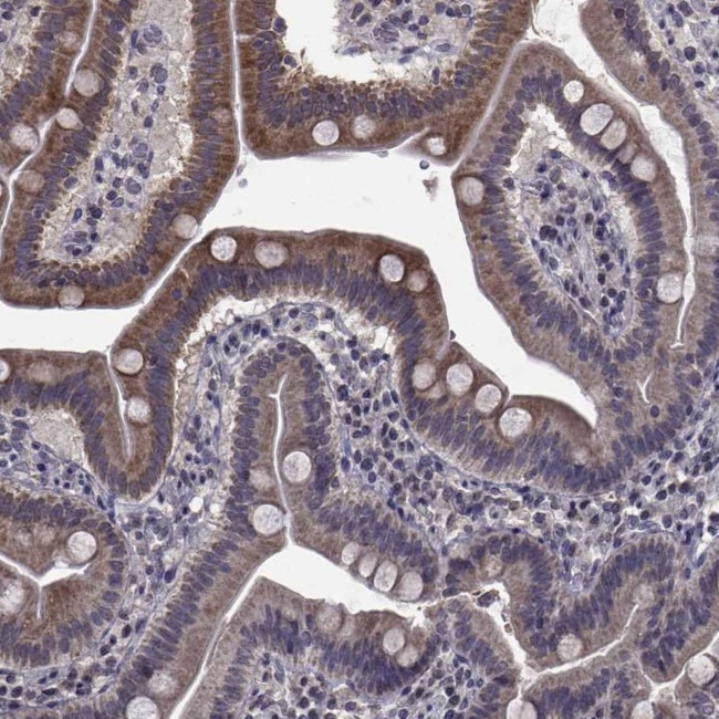 CYP2S1 Antibody in Immunohistochemistry (Paraffin) (IHC (P))