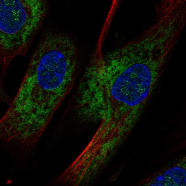 OMD Antibody in Immunocytochemistry (ICC/IF)