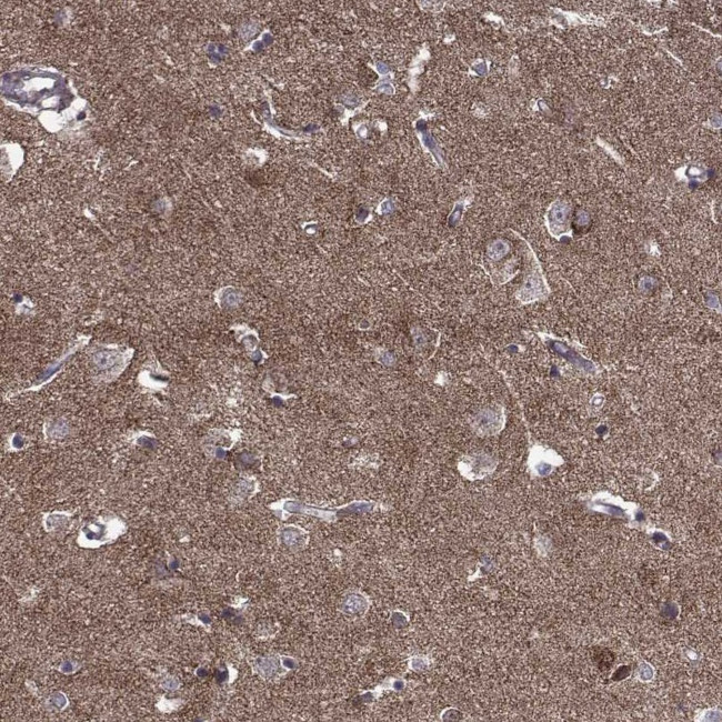 TAB2 Antibody in Immunohistochemistry (Paraffin) (IHC (P))