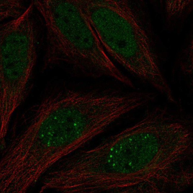 MKNK2 Antibody in Immunocytochemistry (ICC/IF)
