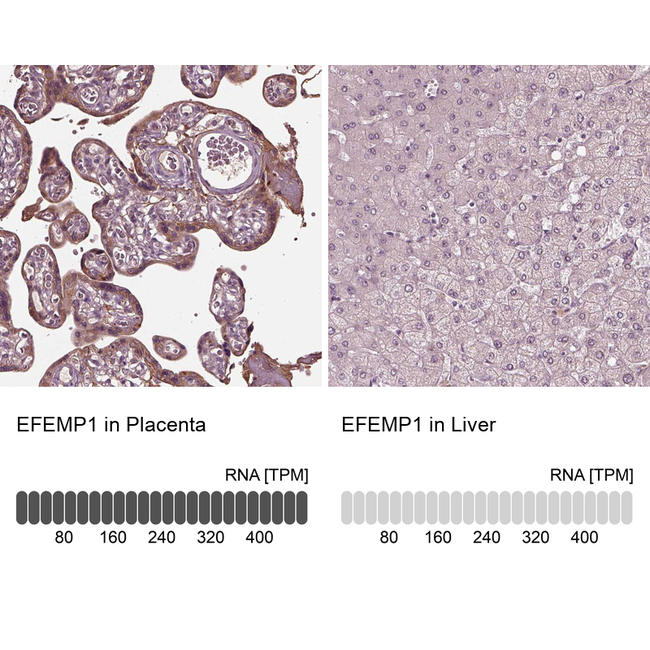 Fibulin 3 Antibody in Immunohistochemistry (Paraffin) (IHC (P))