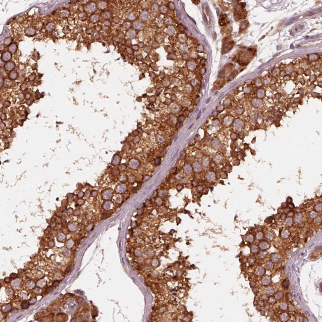 ETEA Antibody in Immunohistochemistry (Paraffin) (IHC (P))