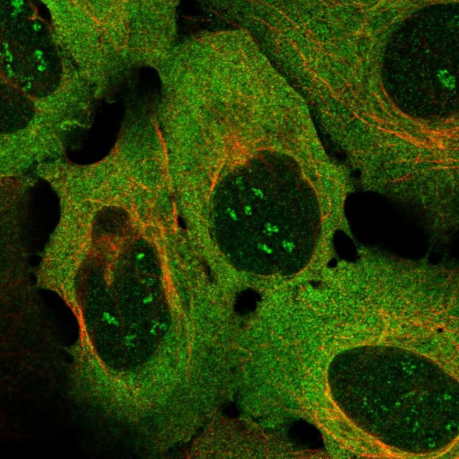 CD137 Antibody in Immunocytochemistry (ICC/IF)