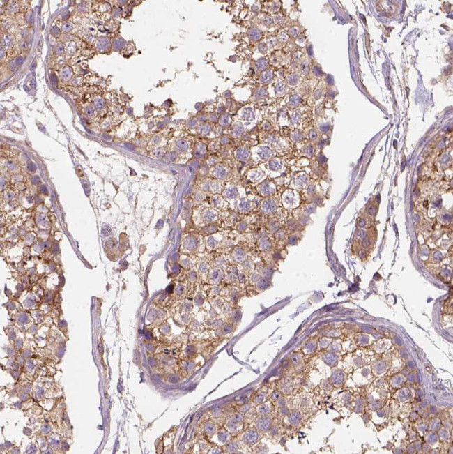 GPRC5D Antibody in Immunohistochemistry (Paraffin) (IHC (P))