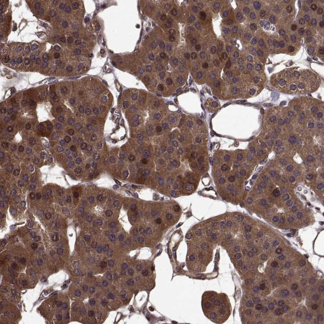 FBXW11 Antibody in Immunohistochemistry (Paraffin) (IHC (P))