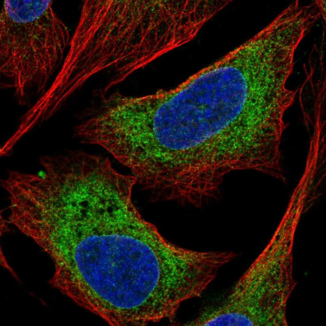 CCDC47 Antibody in Immunocytochemistry (ICC/IF)