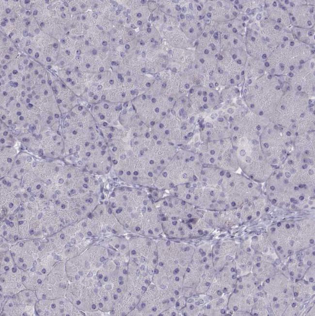 TBX19 Antibody in Immunohistochemistry (Paraffin) (IHC (P))