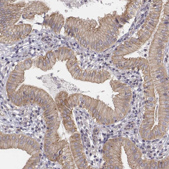 SCARF1 Antibody in Immunohistochemistry (Paraffin) (IHC (P))