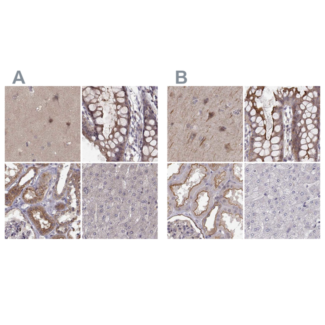 PLEKHG3 Antibody in Immunohistochemistry (Paraffin) (IHC (P))