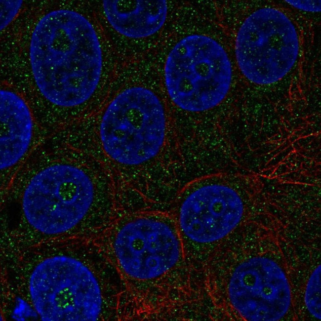 TMEM217 Antibody in Immunocytochemistry (ICC/IF)