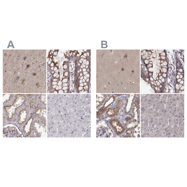 PLEKHG3 Antibody in Immunohistochemistry (Paraffin) (IHC (P))