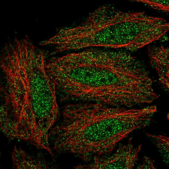 DYRK3 Antibody in Immunocytochemistry (ICC/IF)