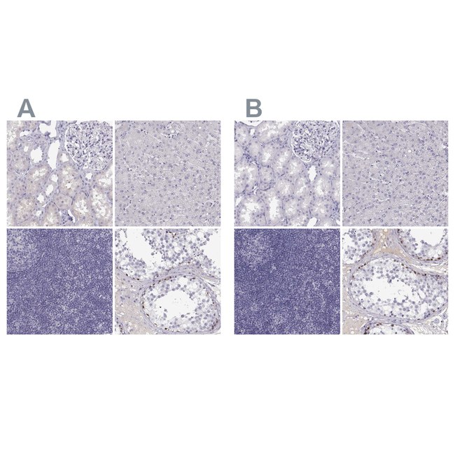 MAGEB2 Antibody in Immunohistochemistry (Paraffin) (IHC (P))